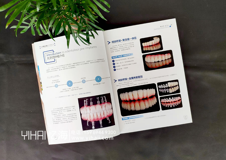 【昆明典冠义齿技术有限公司】产品宣传手册